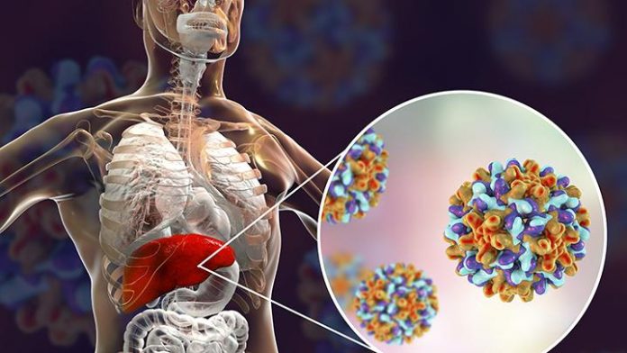 kemenkes imbau masyarakat waspadai penyakit hepatitis akut misterius