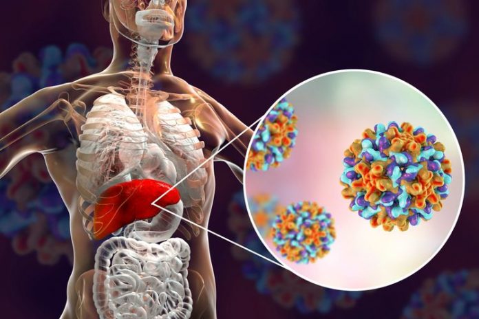 Kasus Hepatitis Akut, Perlu Diwaspadai Tak Perlu Panik